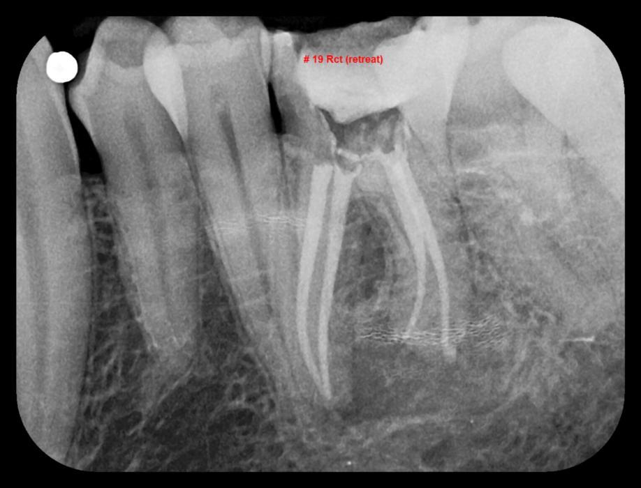 Digital Dental X-Rays in Gaithersburg