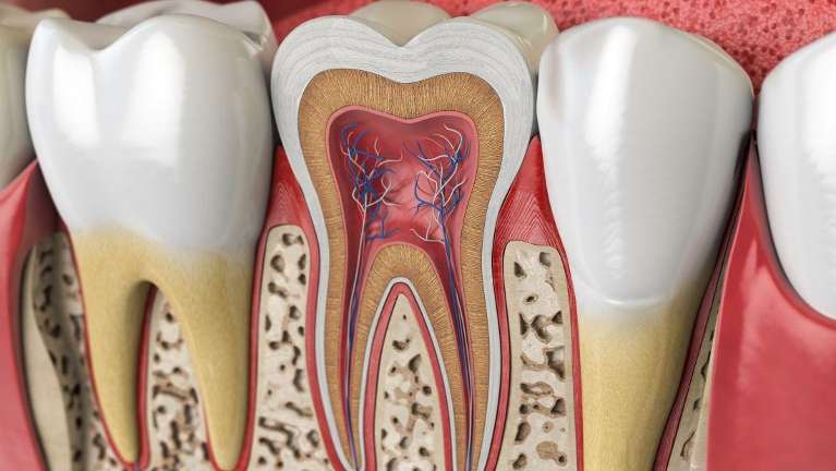Crown Model Shows Tooth Health
