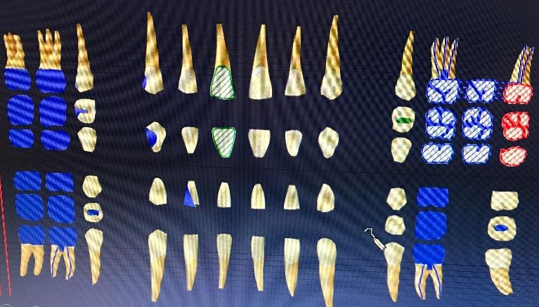 Top-Notch Dental Technology in Gaithersburg